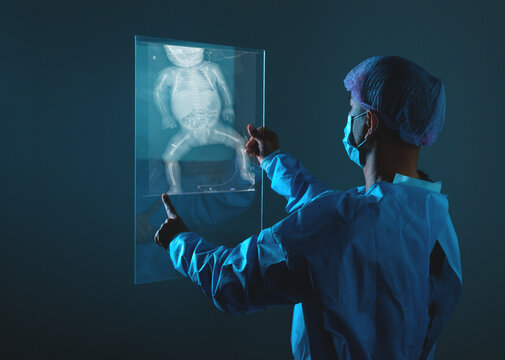 Doctor looking at total hip replacement X-ray film with blurred hospital background.
