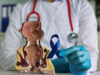 Doctor holding a blue ribbon with a human colon anatomy model
