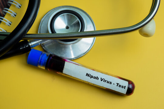 Nipah Virus - Test with blood sample on wooden background. Healthcare or medical concept