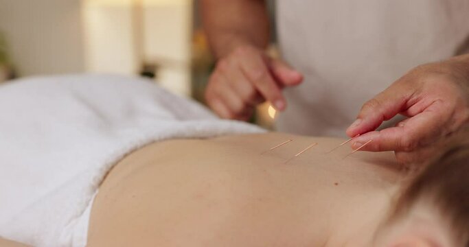 Woman, closeup and back with acupuncture needle for massage, alternative medicine and muscle healing. Relax, patient and person with physical therapy for tension, pain and holistic body treatment