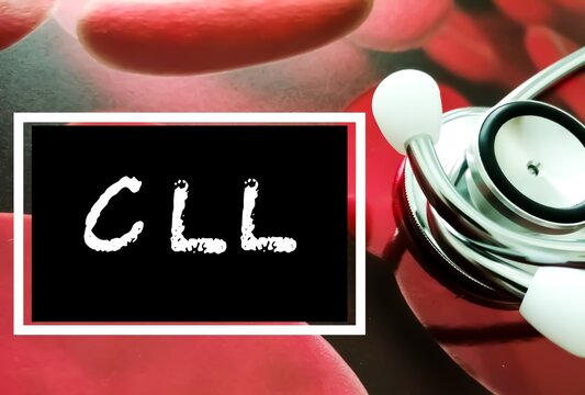 Chronic lymphocytic leukemia (CLL) term, medical conceptual image.