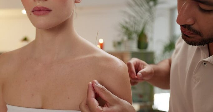 Acupuncture, needle and back in wellness spa, woman or acupuncturist in health clinic for therapy. Holistic healing, healthcare or traditional Chinese practice, pain relief in nervous system