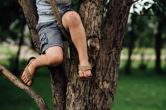 Close up of child's dirty legs climbing tree in summer