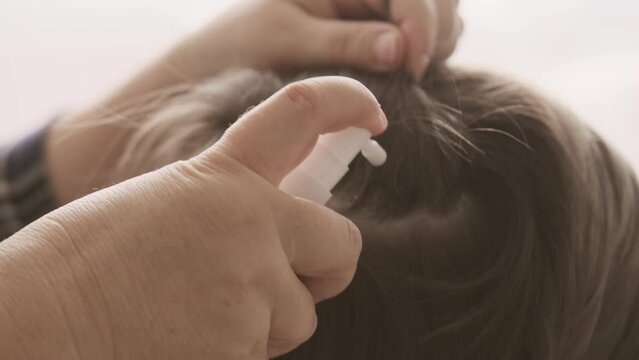 Parent's hands checking child's hair for insects, applying lice and nit treatment in hair, treating with medication, regular hygiene and pest control, Pediculosis, close-up head
