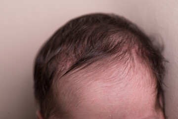 Little tiny head forehead newborn pate 