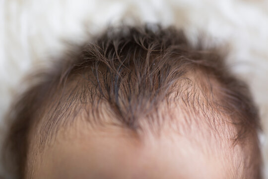 Tiny little newborn human baby head forehead pate