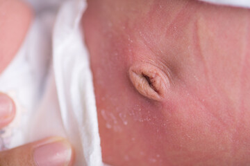 Close up newborn baby belly button