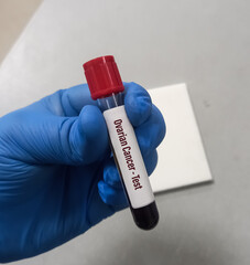 Fototapeta premium Blood sample for Ovarian Cancer test, CA-125 blood test.