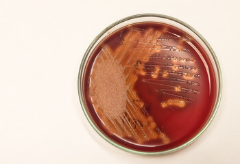 Hemolysis. Bacterial colonies to induce hemolysis when grown on blood agar, streptococcal species...
