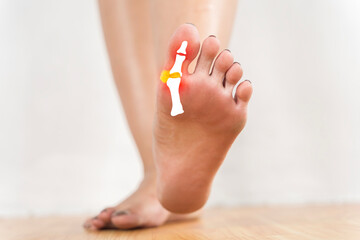 A woman's foot is shown with a yellow bandage on the big toe.
