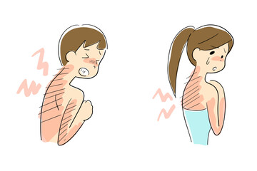 日焼けした背中が痛む男性と女性