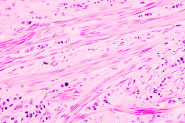 Backgrounds of human cells tissue of lung human under the microscope in pathology lab.View in...