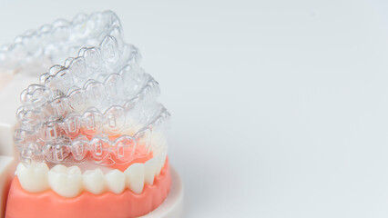 Invisible and removable aligners for teeth alignment