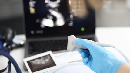 Doctor holds ultrasonic probe in hand preparing device for examination. Ultrasound of internal organs concept