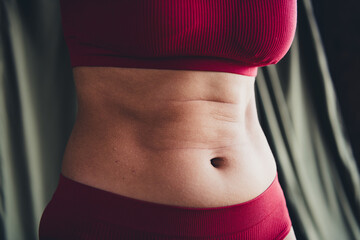 Cropped unretouched photo of girl with stretch marks fitness motivation concept isolated green line...