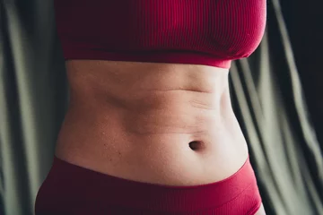 Gardinen Cropped unretouched photo of girl with stretch marks fitness motivation concept isolated green line background © deagreez