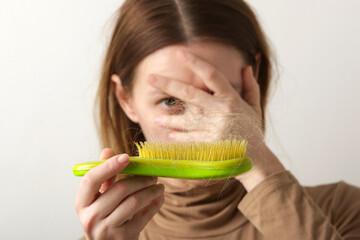 Woman holding detangler hair brush full of hair that has fallen out, loss hair problem