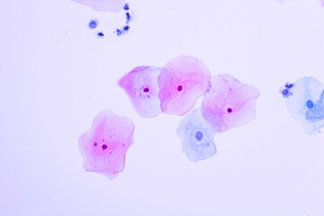 View in microscopic of human skin cells.Squamous epithelium cells.Superficial and intermediate epithelial cells.Cytology and pathology laboratory department.Magnification 400 X