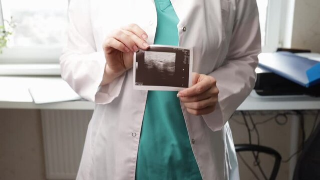 Gynecological ultrasound in doctor's hands, examining a woman's pelvic organ, medical scan for female health