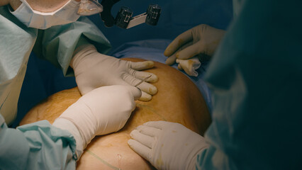 Two men doctors surgeon physician hands cut scalpel make incision on patient abdomen stomach belly...