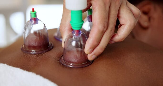 Hands, cupping therapy and back of person in spa for body treatment or muscle pain with vacuum cups. Massage or therapist, client and reduce inflammation with jar for health, wellness and relax
