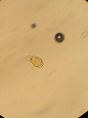 Photo of pollen seeds as seen under the microscope
