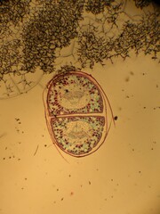 photo of section of plant tissue under the microscope

