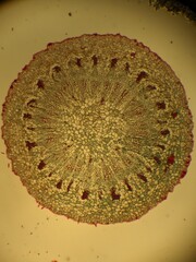 photo of section of plant tissue under the microscope
