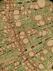 section of plant tissue under the microscope