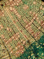 section of plant tissue under the microscope