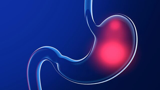 3D animation of stomach with burning. Anatomical cut of transparent glass with lights and reflections on a dark blue background.
