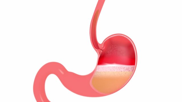 Anatomical 3D animation of the inside of the stomach doing digestion. With heartburn and reflux. Cut out on white background.