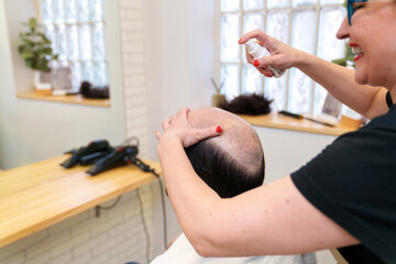 Specialist sprays treatment on scalp for prosthesis preparation