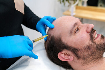 Clinic offers PRP therapy for male pattern baldness with professional care.
