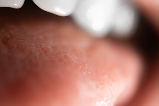 A Human Mouth With Tongue