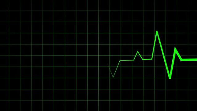Glowing Pulse: EKG/ECG Heart Monitor Loop – Animated Heartbeat Icon in Health Care Video