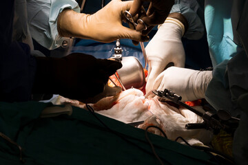 A group of surgeons remove a surgical operation to cut out a cancerous tumor or liver, kidney,...