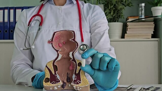 Soft suppository with laxative or for treatment of proctological diseases in hands of doctor. Proctologist and treatment of constipation in patients