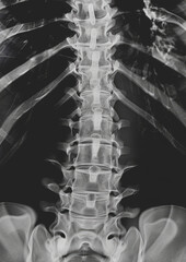 X-ray of bones. Aesthetics of X-rays. Generative AI - 783730503