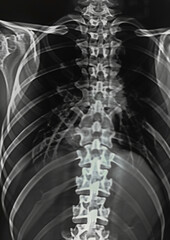 X-ray of bones. Aesthetics of X-rays. Generative AI - 783730524