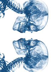 X-ray image of the human skulls. Aesthetics of  X-rays. Generative AI - 783730582