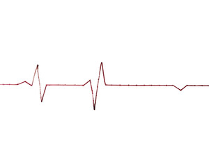 Naklejka premium electrocard diagram on grid paper