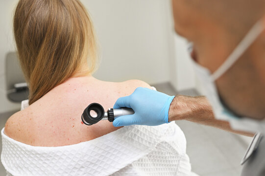 dermatologist examines neoplasms on the patient's skin using a special dermatoscope device. Prevention of melanoma.
