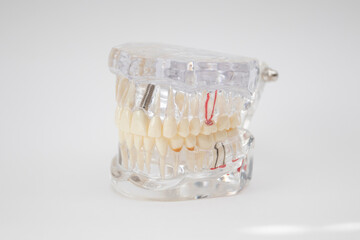 Demonstration plastic jaw on a white background