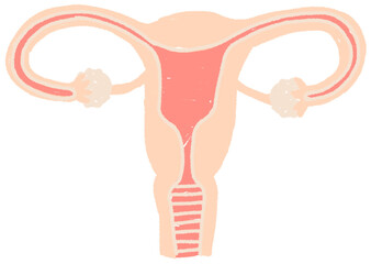 Polycystic Ovary Syndrome. Female Reproductive System With Ovarian Cysts