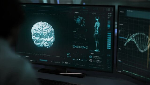 Medical diagnosis system is scanning the human organs. Medical diagnosis system searches for deformities in the brain. Medical diagnosis system has detected cancerous growth in the brain. Tumor. UI.