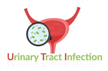 Urinary tract infection(UTI) vector. Illustration of infect the urinary tract.
