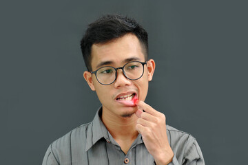 Asian man has aphthous boils on his lips. - obrazy, fototapety, plakaty