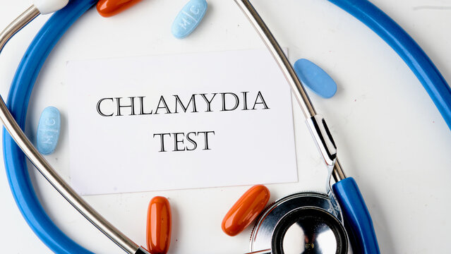 Medical concept. Chlamydia Test text on the card on a white background. Concept photo