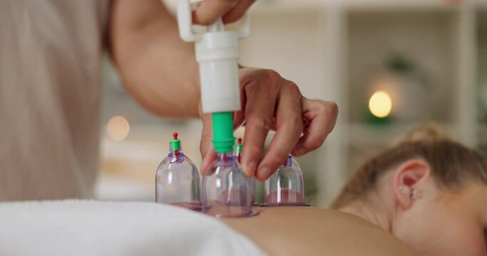 Masseur, cupping therapy and back of person in spa for treatment, body or muscle pain with vacuum cups. Massage or therapist, client and skincare with jar for health, wellness and relax or rest